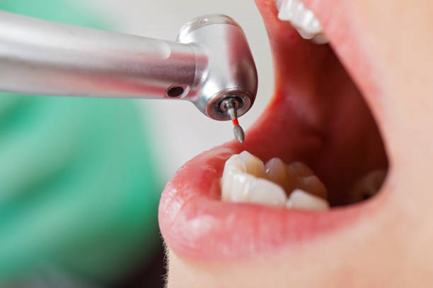 Best Walk-In Emergency Dental Services in Panora, IA
